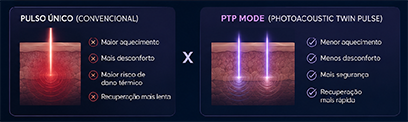 Comparativo entre pulso único convencional e PTP Mode