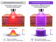 Comparativo entre feixe gaussiano convencional e TOP-HAT Beam